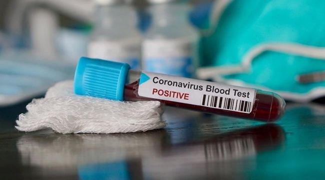 Koronavirüs tablosu açıklandı! Uzun süredir yüksek seyreden vakalarda düşüş