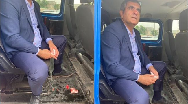 CHP Milletvekili Ali Şeker Şanlıurfa 'da saldırıya uğradı iddiası