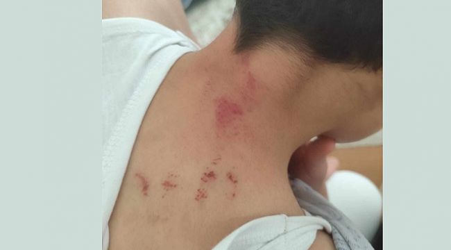 Öğrencisini Darp Eden Öğretmen Tutuklandı