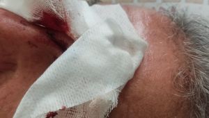 Şanlıurfa’da Sahipsiz Köpek Terörü: Sporcuları Parçalamaya Kalkıştılar
