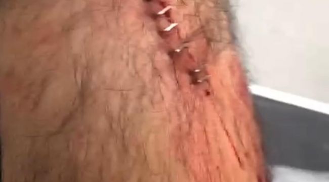 Şanlıurfa’da Öğretmene Jiletli Saldırı! 